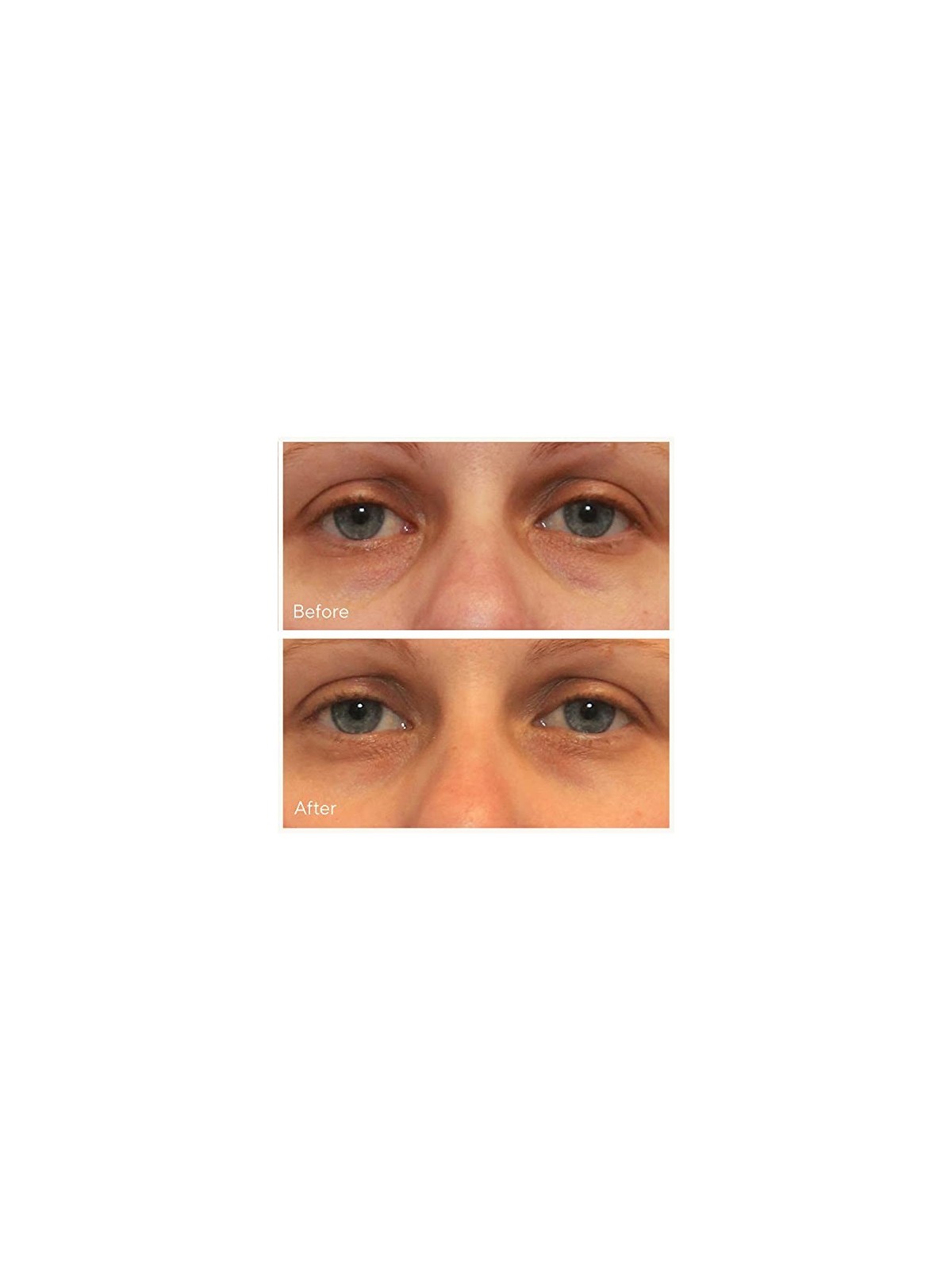 Murad Vita-C Rapid Dark Circle Corrector 15ml Murad www.essenzetotalstyle.com 