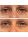 Murad Vita-C Rapid Dark Circle Corrector 15ml Murad www.essenzetotalstyle.com 