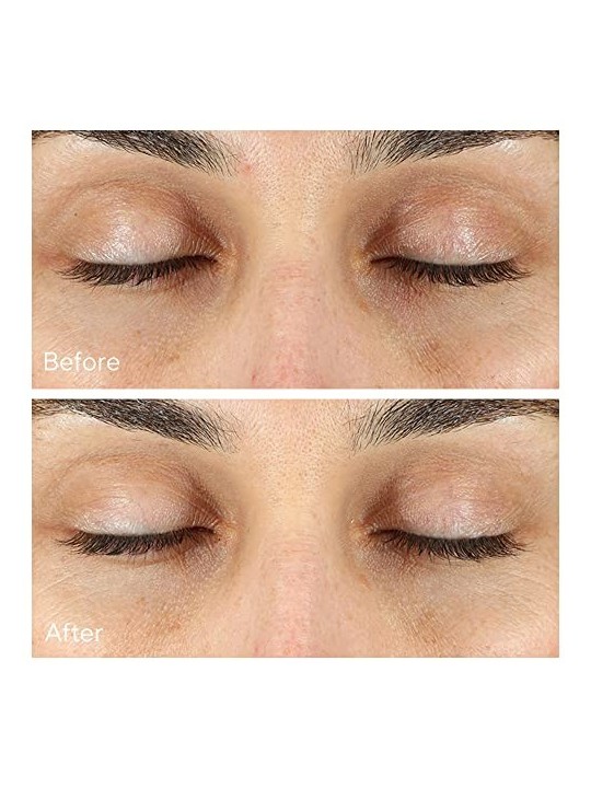 Murad Vita-C Rapid Dark Circle Corrector 15ml Murad www.essenzetotalstyle.com 