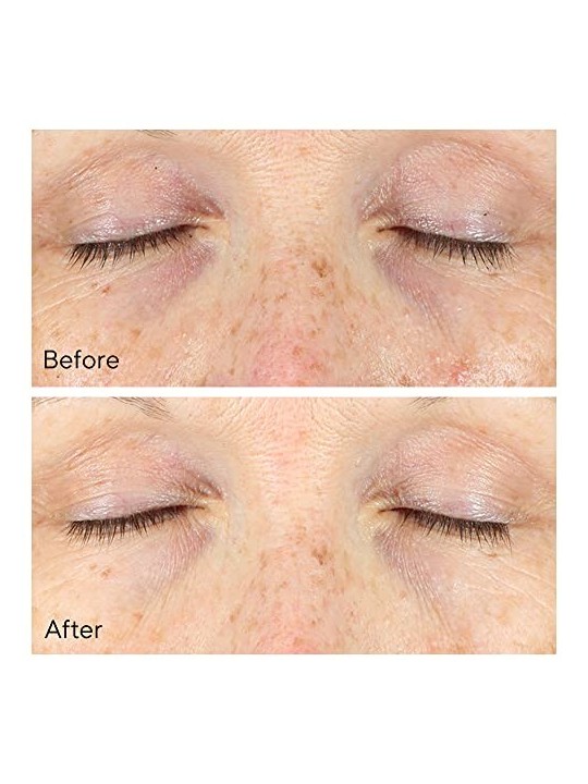 Murad Vita-C Rapid Dark Circle Corrector 15ml Murad www.essenzetotalstyle.com 