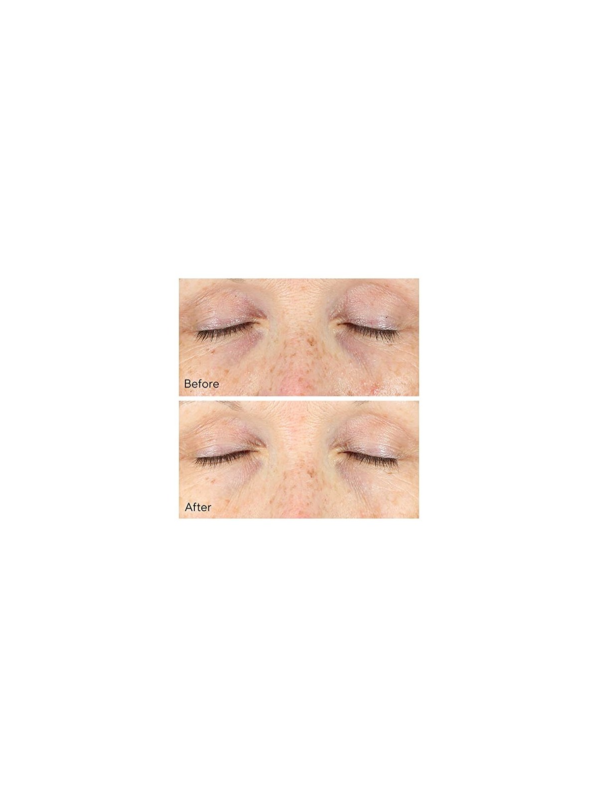Murad Vita-C Rapid Dark Circle Corrector 15ml Murad www.essenzetotalstyle.com 