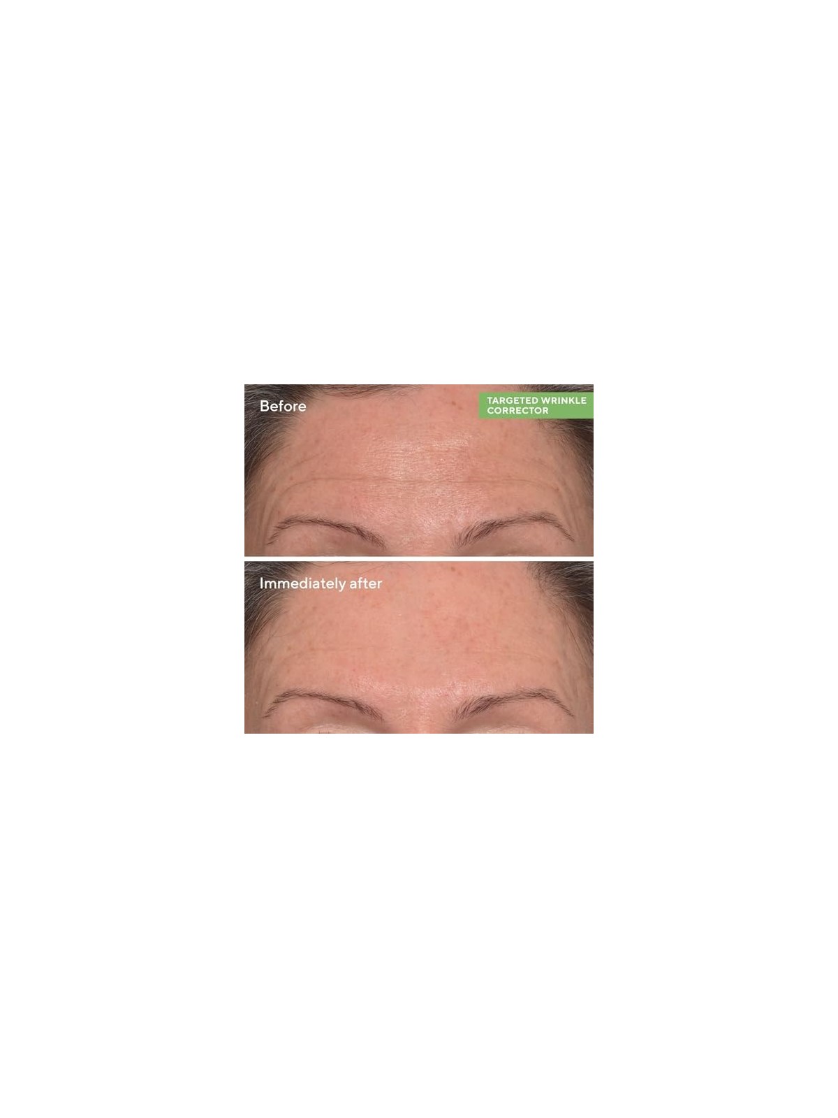 Murad Resurgence Targeted Wrinkle Corrector 15ml