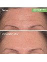 Murad Resurgence Targeted Wrinkle Corrector 15ml