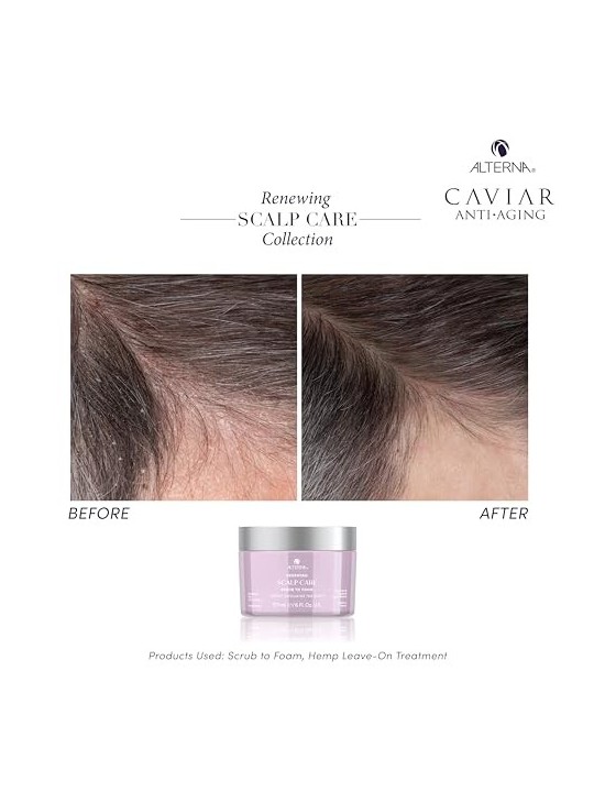 Alterna Trattamento Esfoliante per il Cuoio Capelluto Senza Parabeni 177ml donna