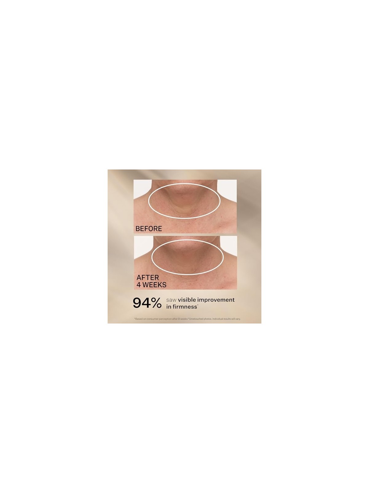 Strivectin TL Advanced Tightening Neck Cream 30ml StriVectin www.essenzetotalstyle.com 