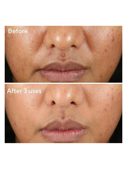 Murad Rapid Relief Sulfur Mask 74ml Murad Skincare www.essenzetotalstyle.com 