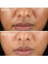 Murad Rapid Relief Sulfur Mask 74ml Murad Skincare www.essenzetotalstyle.com 