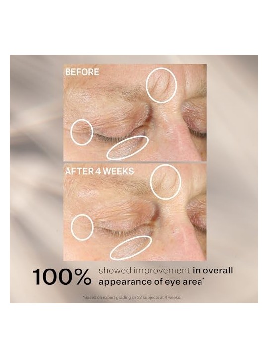 Strivectin Intensive Eye Concentrate For Wrinkles donna 30ml