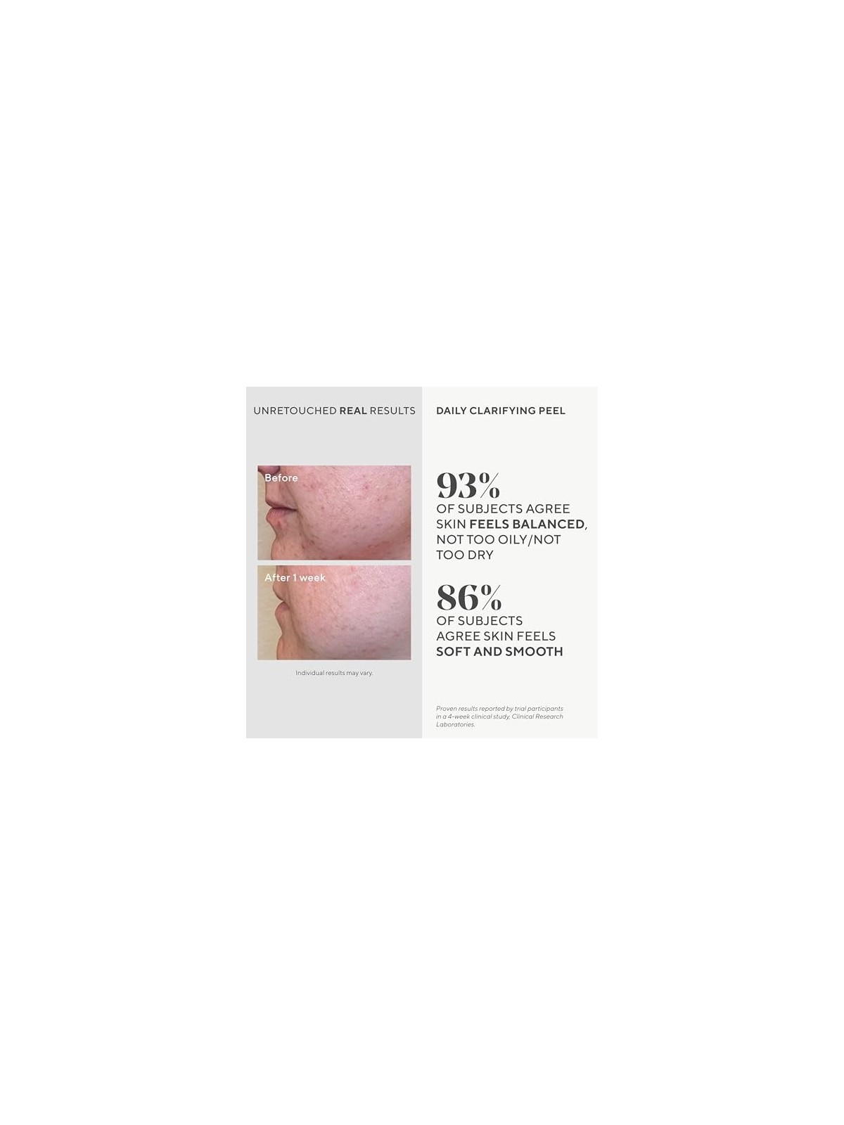Murad Lozione Peeling Quotidiano AHA/BHA 95ml donna