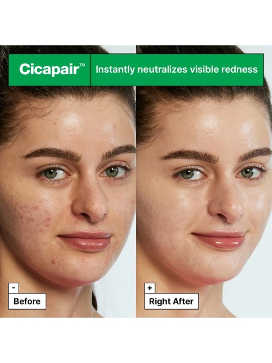 Dr.Jart+ Cicapair™ Tiger Grass Color Correcting Treatment 30ml Crema colorata intensiva che riduce i rossori della pelle donna D