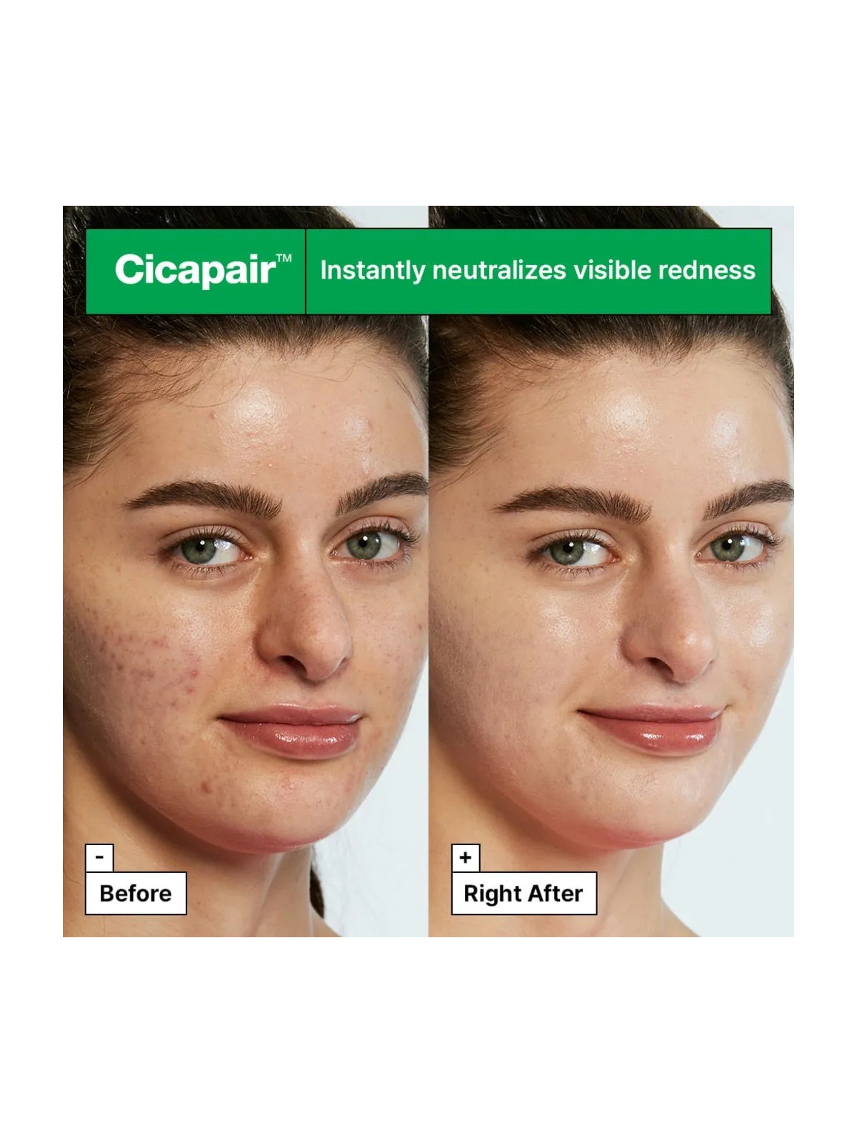 Dr.Jart+ Cicapair™ Tiger Grass Color Correcting Treatment 30ml Crema colorata intensiva che riduce i rossori della pelle donna D