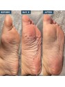 Voesh Calzini esfolianti Peeling Calze con acidi AHA ed estratti botanici 40ml