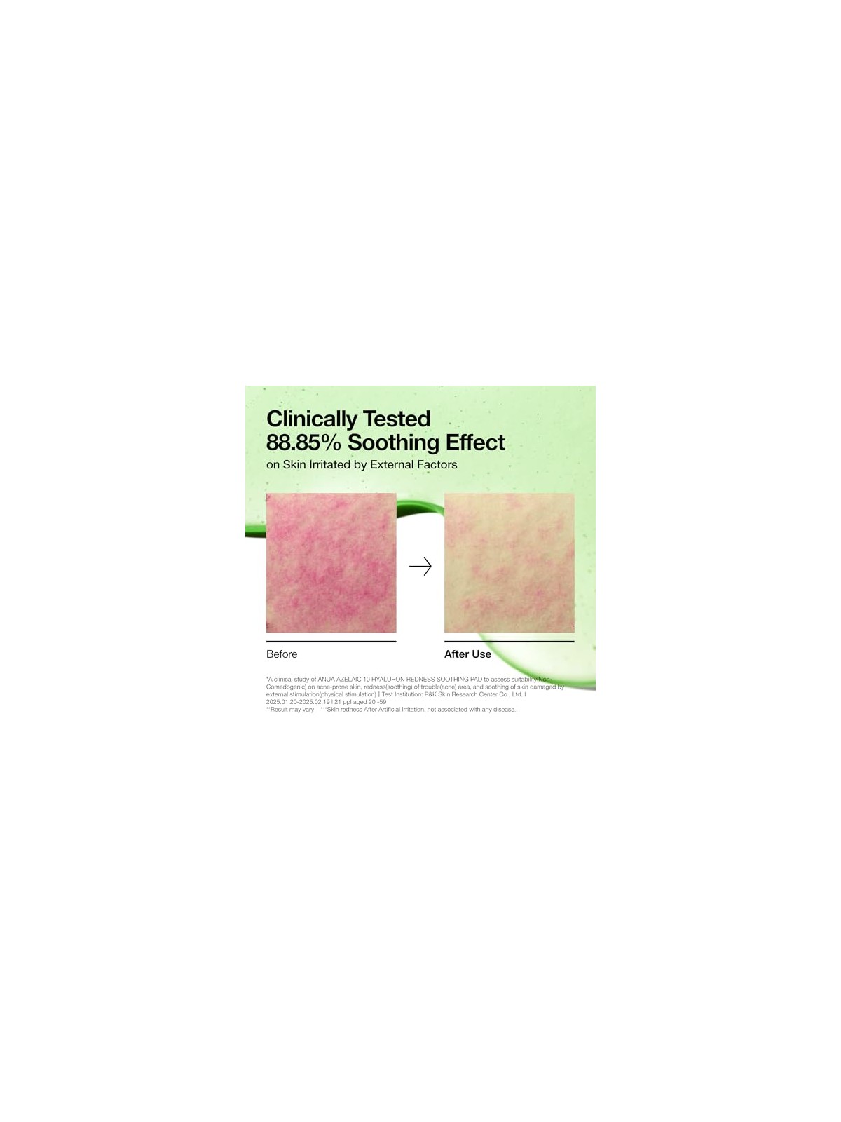ANUA Azelaic Acid Pad - Lenitivo per Rossori