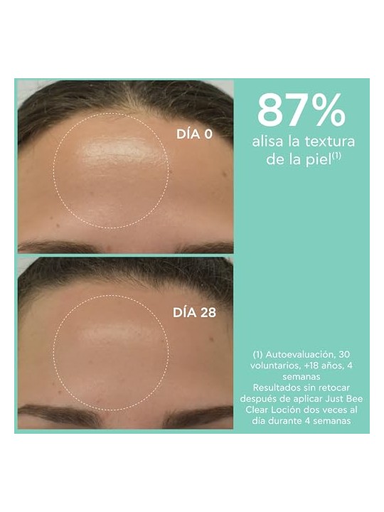 Apivita JUST BEE CLEAR Lozione purificante minimizzante dei pori per pelligrasse 200ml unisex