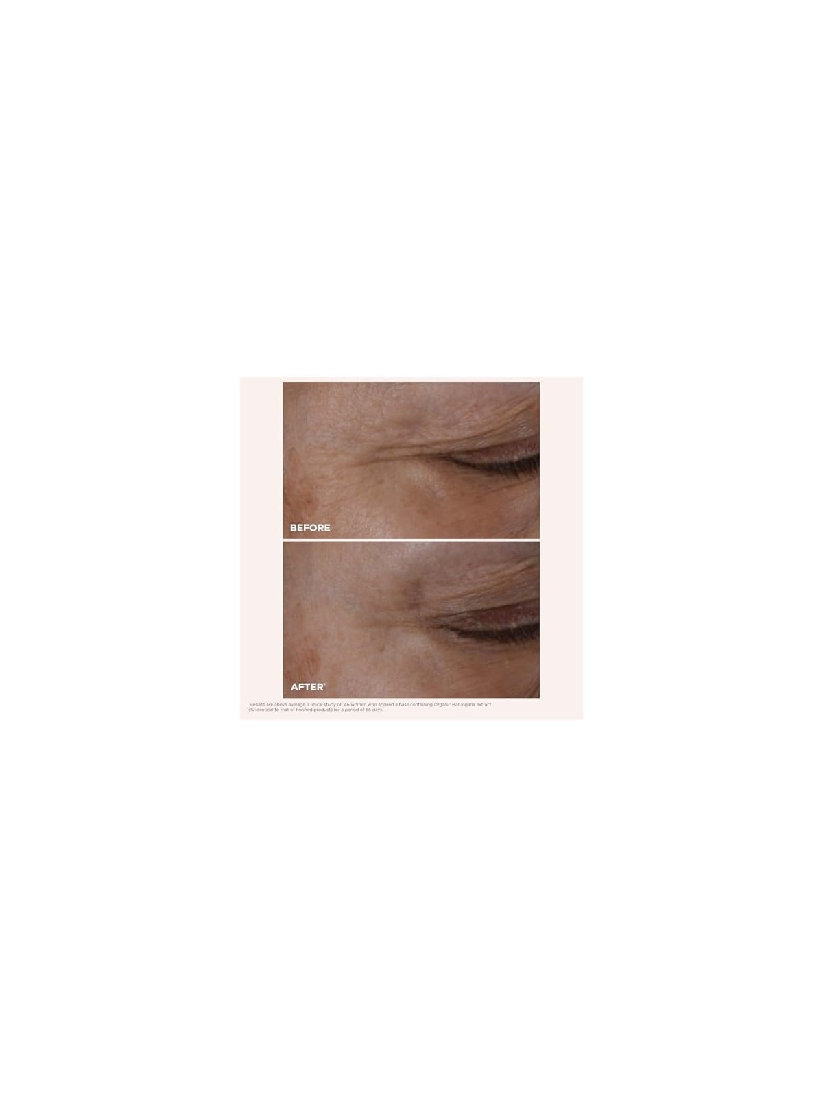 Clarins Ricarica TOTAL EYE LIFT 15ml donna