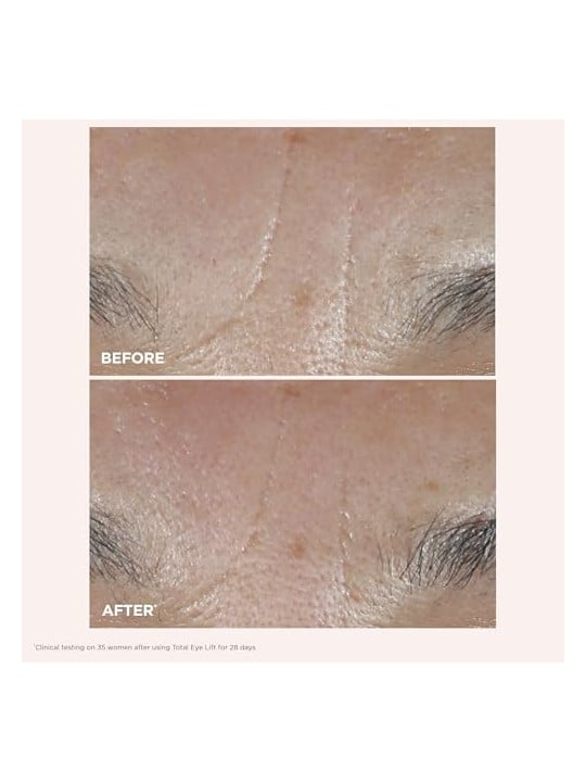 Clarins Ricarica TOTAL EYE LIFT 15ml donna
