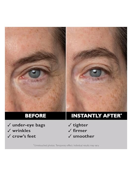 P.T. Roth Instant Firmx Temporary Eye Tightener For All