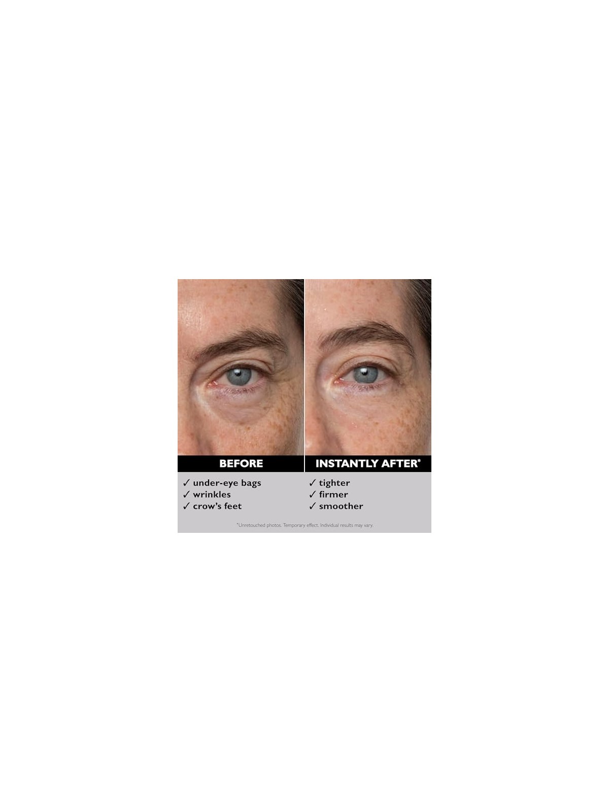 P.T. Roth Instant Firmx Temporary Eye Tightener For All