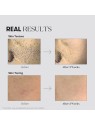 VT Cosmetics Maschera in tessuto illuminante Tx-Toning Daily Mask, 30 pezzi donna