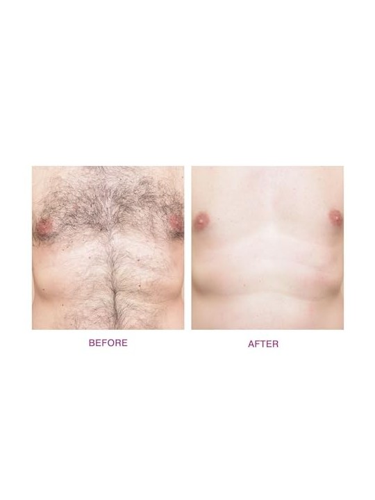 RioBeauty Set di compresse di cera dura per la ceretta totale del corpo donna 1 unit