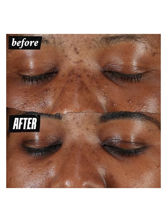 Kiehl's Clearly Corrective Dark Spot Solution 100ml