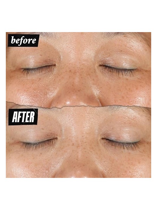Kiehl's Clearly Corrective Dark Spot Solution 100ml