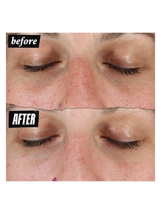 Kiehl's Clearly Corrective Dark Spot Solution 100ml