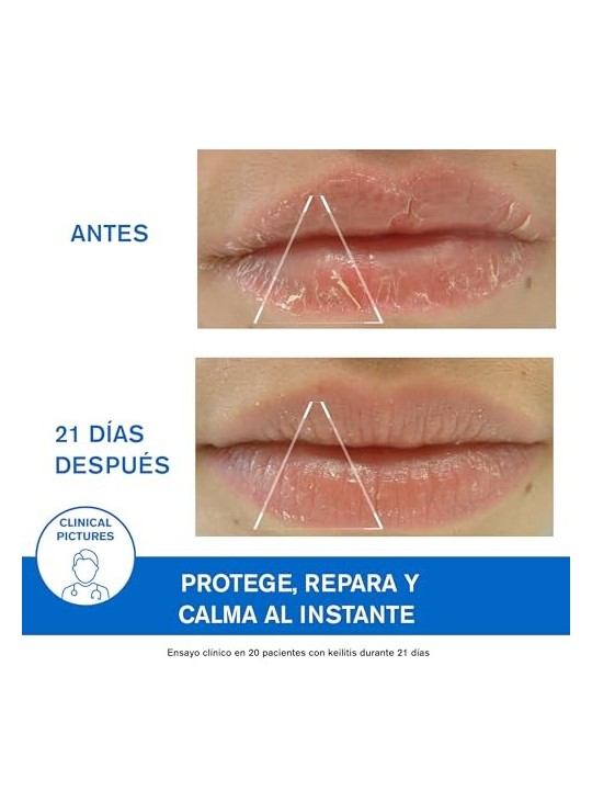 Uriage BARIï¿½ï¿½DERM cica labbra 15ml