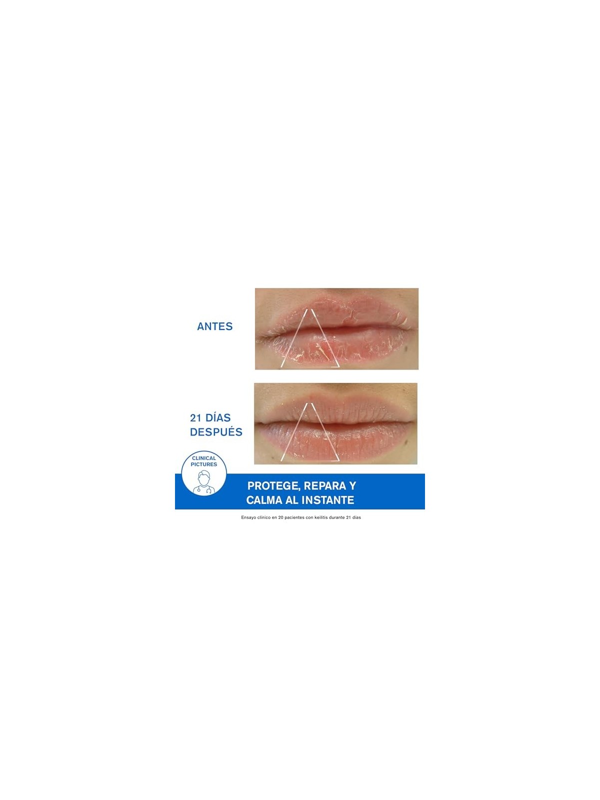 Uriage BARIï¿½ï¿½DERM cica labbra 15ml