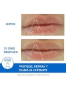 Uriage BARIï¿½ï¿½DERM cica labbra 15ml