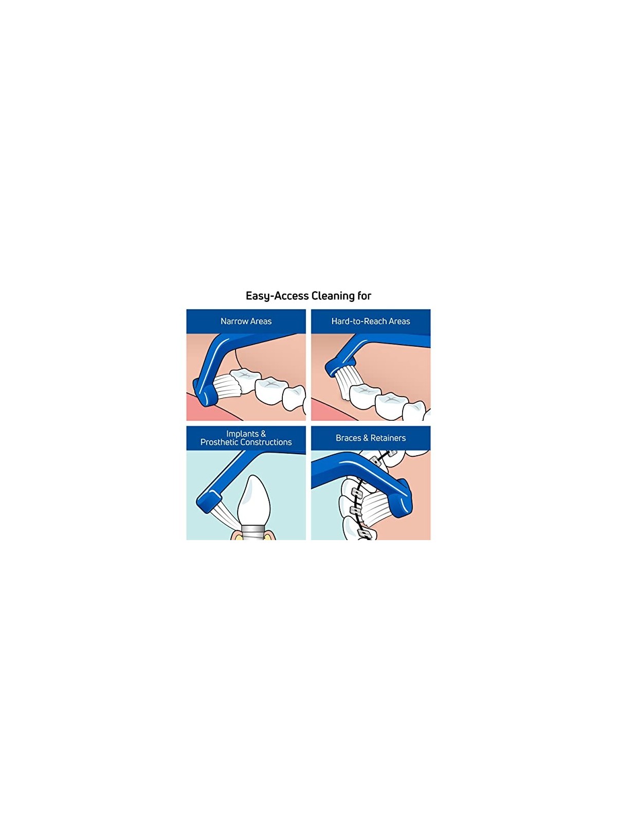 TEPE Implant Care spazzola per la pulizia degli impianti
