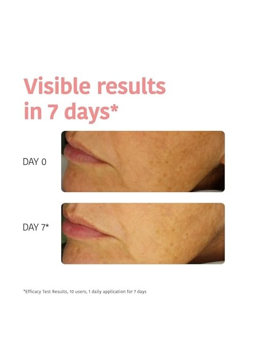Iroha MASCHERA DI TESSUTO illuminante vitamina C HA 1 unit donna