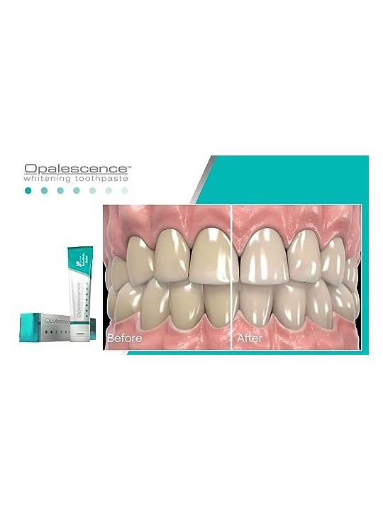 Dentifricio Opalescence Sbiancante Sensibilità Unisex 100ml