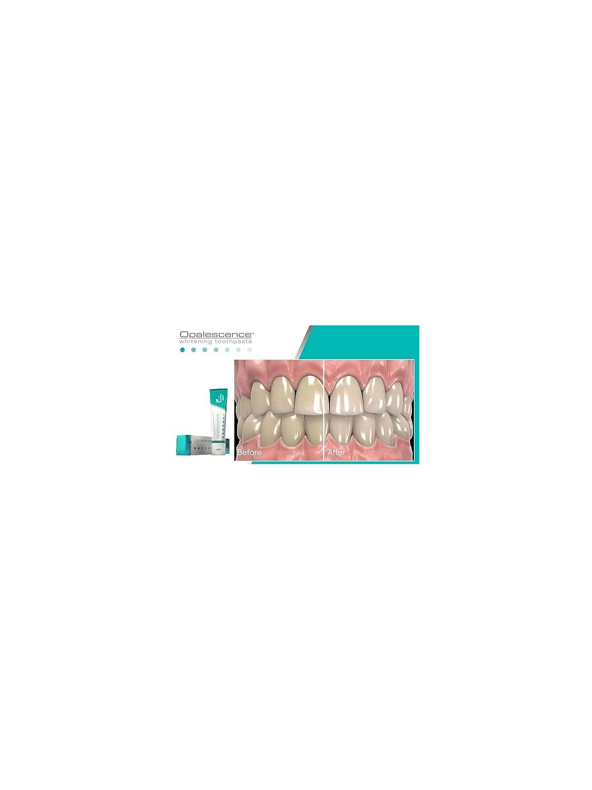 Dentifricio Opalescence Sbiancante Sensibilità Unisex 100ml