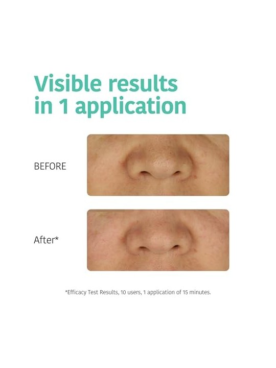 Iroha DETOX CHARCOAL BLACK Nose Strips 5pcs Women
