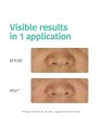 Iroha DETOX CHARCOAL BLACK Nose Strips 5pcs Women