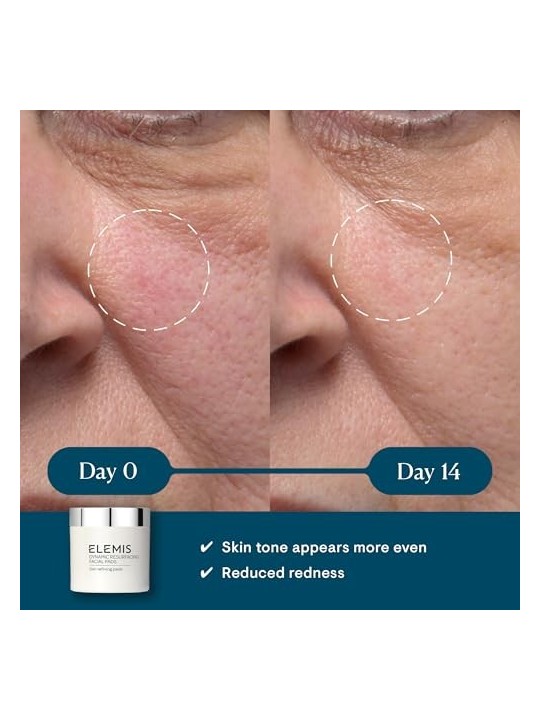 Elemis Dynamic Resurfacing Facial Pads 60 unità acquista 