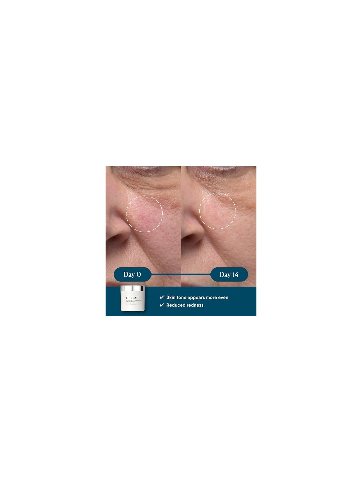 Elemis Dynamic Resurfacing Facial Pads 60 unità acquista 
